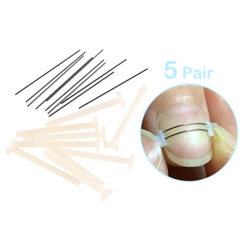 5Pairs Profesionalus įaugęs nagų korektorius Pedikiūras Recover Embed Pirštų nagų gydymas Pėdų priežiūros įrankis